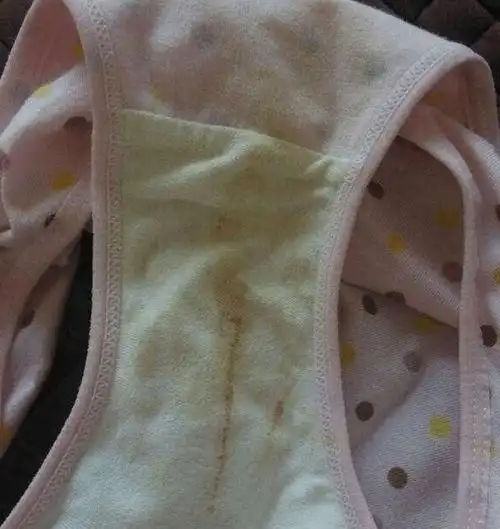 3岁女儿内裤有带血分泌物医生检查后宝妈惭愧不已