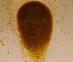 请问拉稀拉水怎么办?