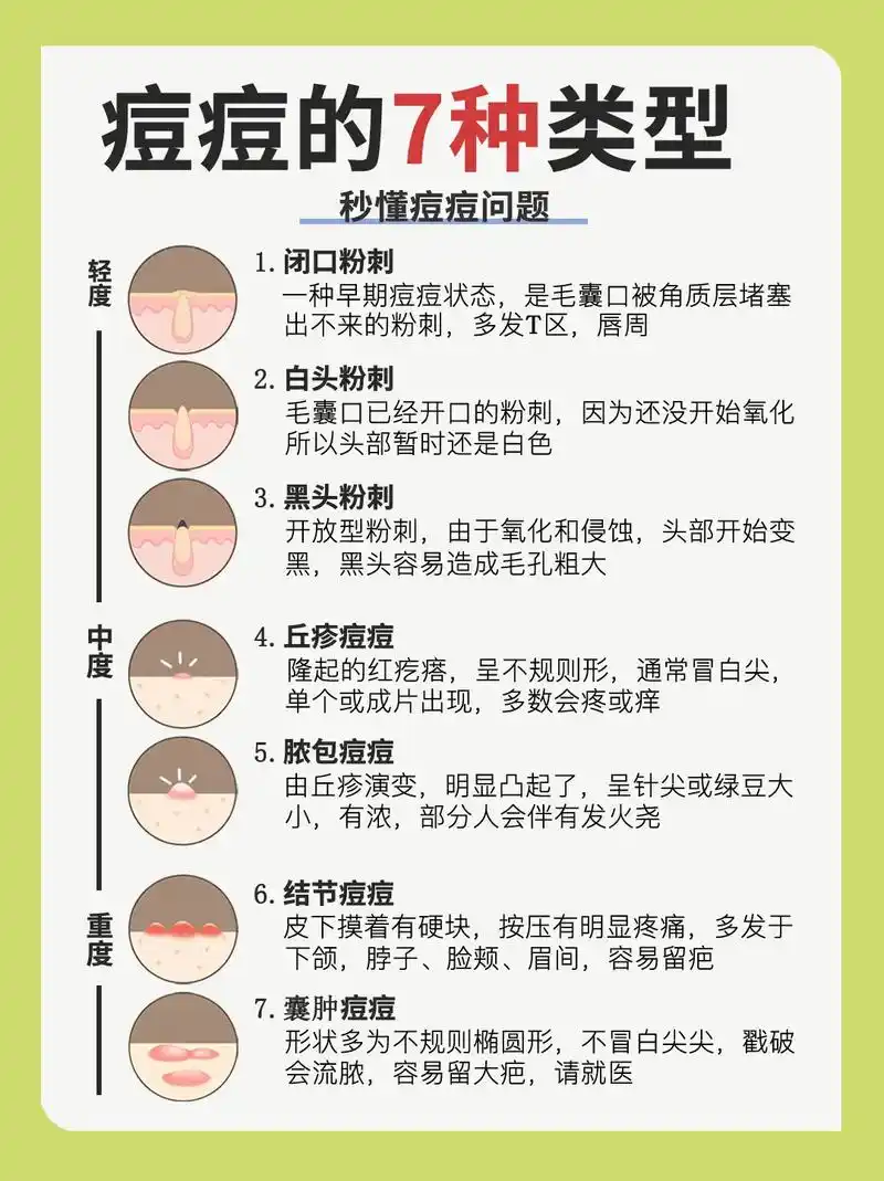 97痘痘的7种类型75不易长痘的护肤好方法.
