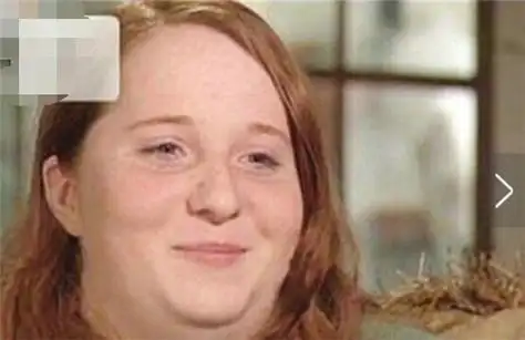 世界上第一位眼睛有透视功能的女孩