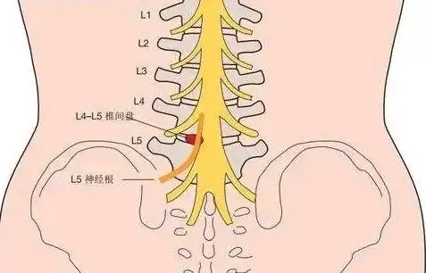 骶骨疼痛的原因有哪些? - 春雨医生