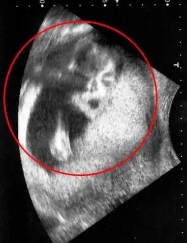 英孕妇做b超惊现歌王杰克逊影像