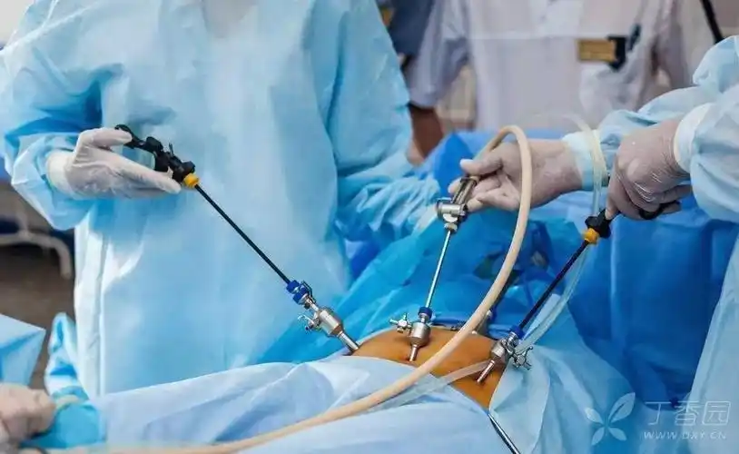 腹腔镜手术后,肩膀疼是什么原因?如何治疗?