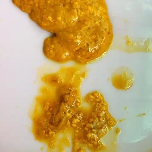 宝宝大便这样的要紧吗