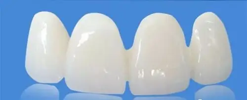 二氧化锆全瓷牙必将赢得天下!