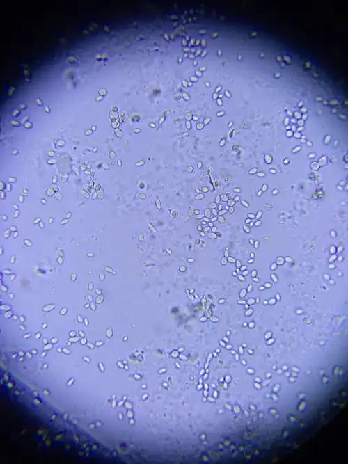 大家帮我看看,这是酵母吗?