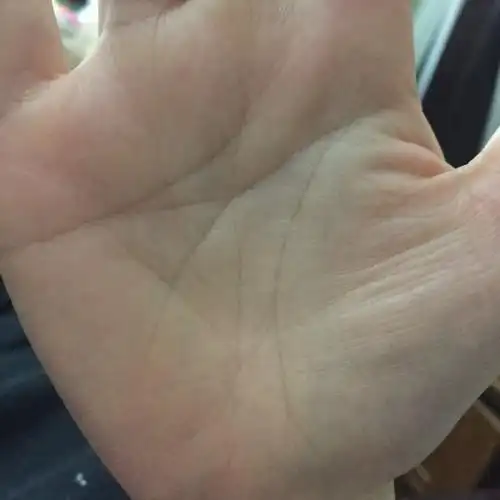 求大师看手相,坎宫有三角纹,怎么破?