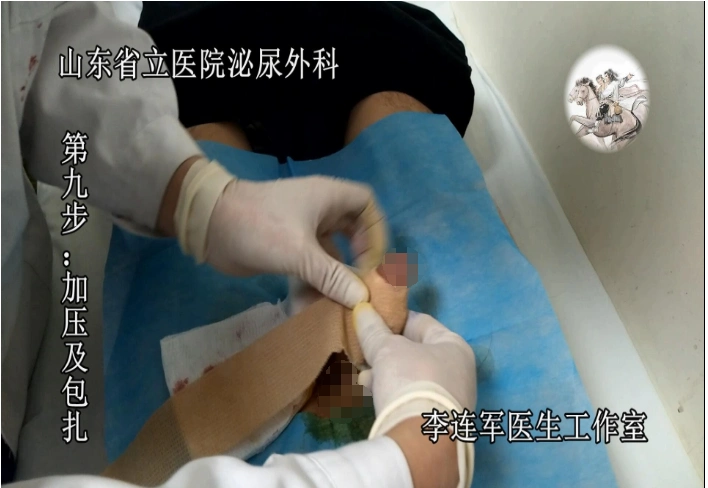 想要做手术的患者可以参考以上的图片步骤,大体就是这个情况,这样就不