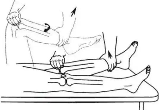 髋关节|屈曲|髌骨|肌腱_网易订阅