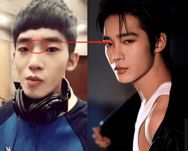 于适旧照曝光,山根凹陷小单眼皮,被嘲路人脸整商高_普通人_刚需_明星