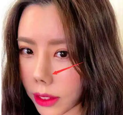 女生"塌鼻子"不算啥,若是这3种鼻型,颜值才是"有苦难言"!
