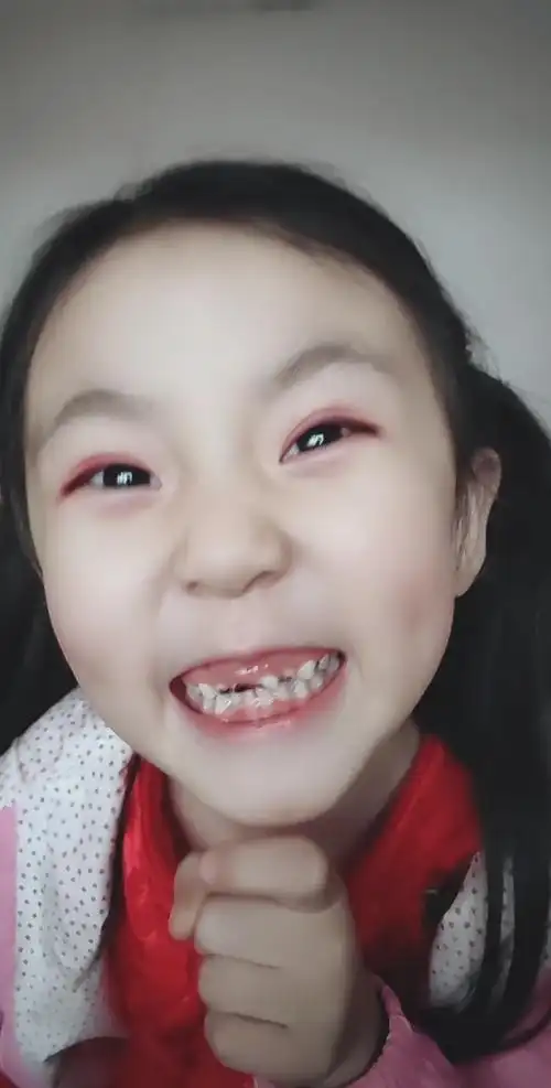 暗算我的来,大豁牙