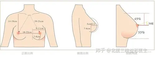 乳房的美学标准你和完美乳房之间差了点什么