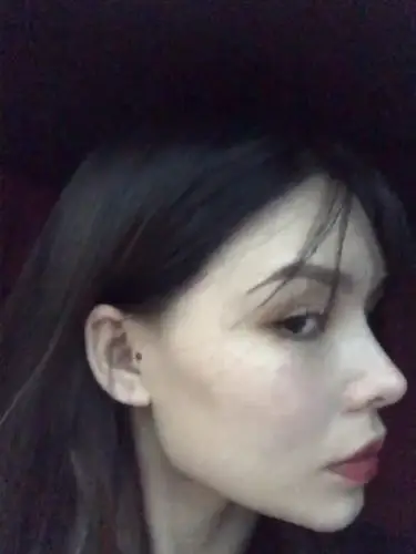 脸部注射瘦脸针后凹陷该如何恢复?