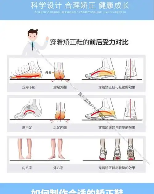 内八字矫正鞋儿童扁平足外翻小孩长短腿马蹄足内翻踮脚纠正器宝宝垫