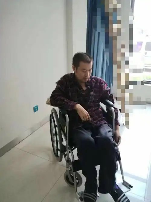 脑梗塞后遗症到院针灸理疗一个疗程效果