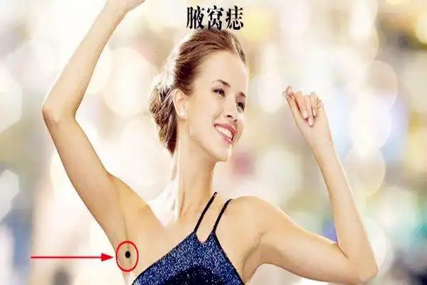 腋窝附近长痣代表什么
