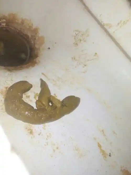 这样的大便正常吗