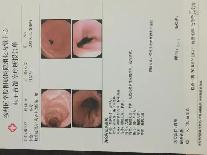 慢性非萎缩性胃炎的介绍_百度知道