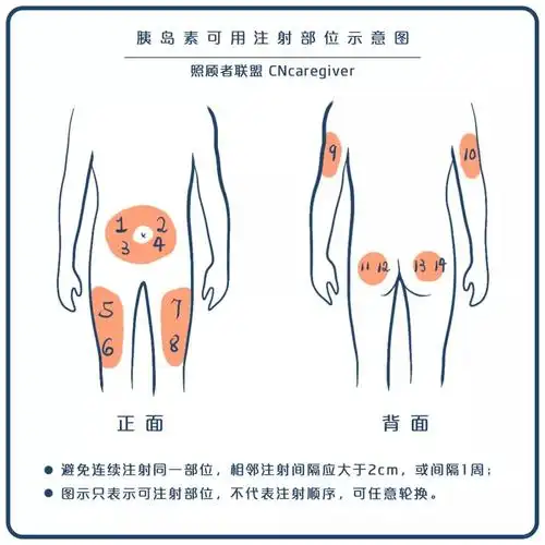 糖尿病患者使用和储存胰岛素,首先要知道这些