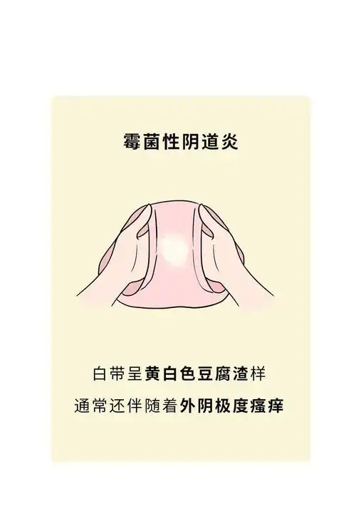 也可以去打一下hpv疫苗,一定程度上可以防止感染高危型hpv,预防宫颈癌