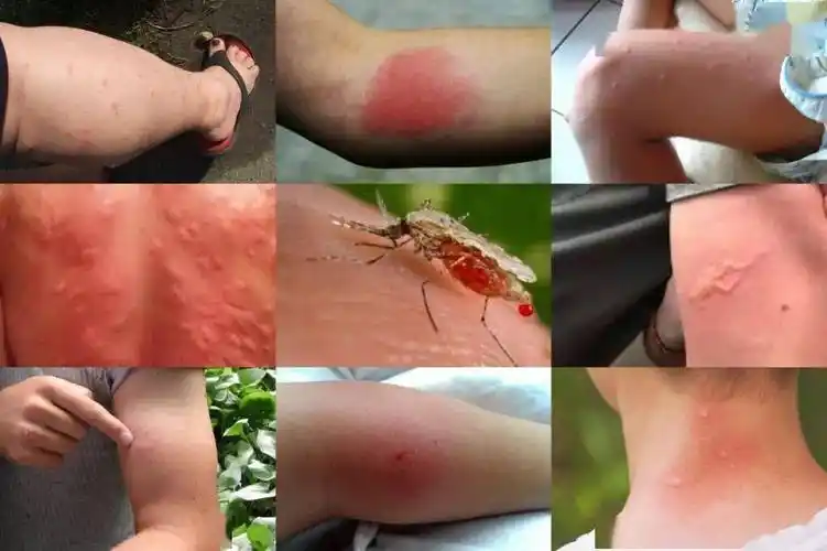 目的夏季虽然过了但"秋蚊"咬人更狠家里放盒它别说蟑螂了蚊子也别想近