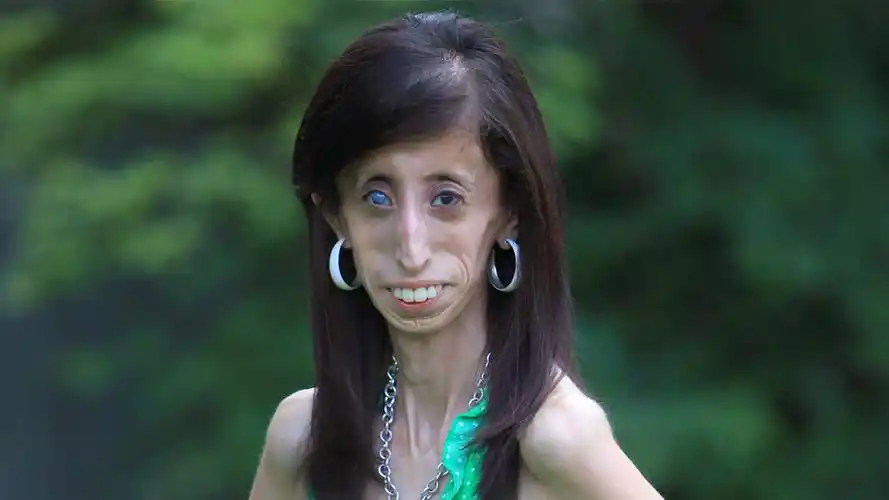 "全球最丑女人"笑对恶言,怒成人生赢家