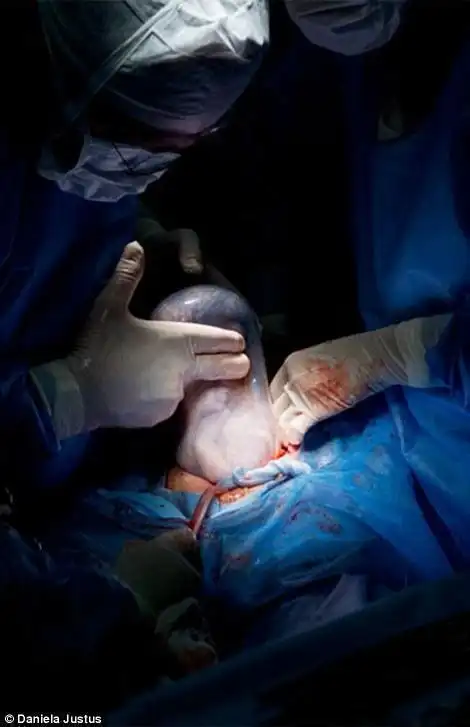 经医生诊治后发现陈茵媺之所以没能止血,是因生产时阴道撕裂而发炎