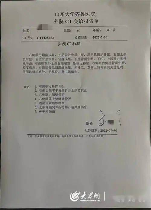 报告单显示:1.右侧颧弓粉碎骨折;2.