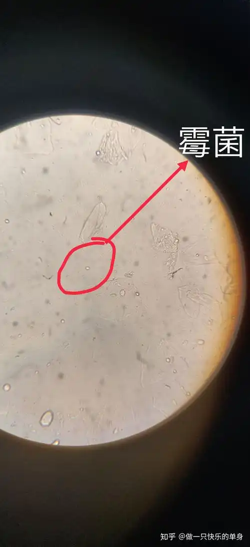 妇科白带常规显微镜下图片
