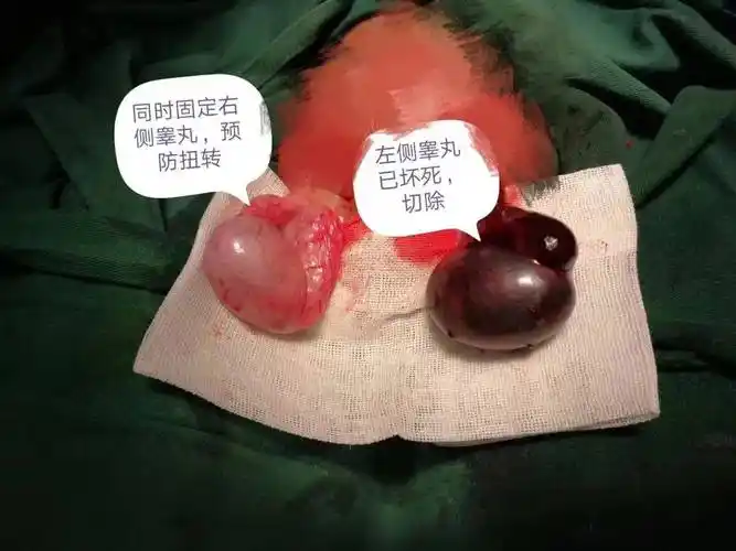 则会出现坏死,最终只能够通过手术将坏死的睾丸切除