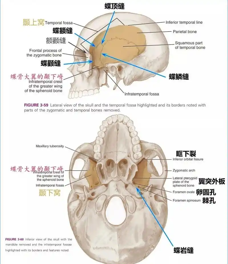 与多块颅骨相连,可分为体,大翼,小翼,翼突四个部分: 蝶骨参与构成多个