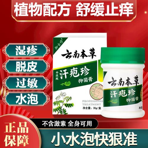 醋酸地塞米松乳膏汗疱疹手上起小水泡药膏手痒手脱皮干裂汗疱疹药膏 1