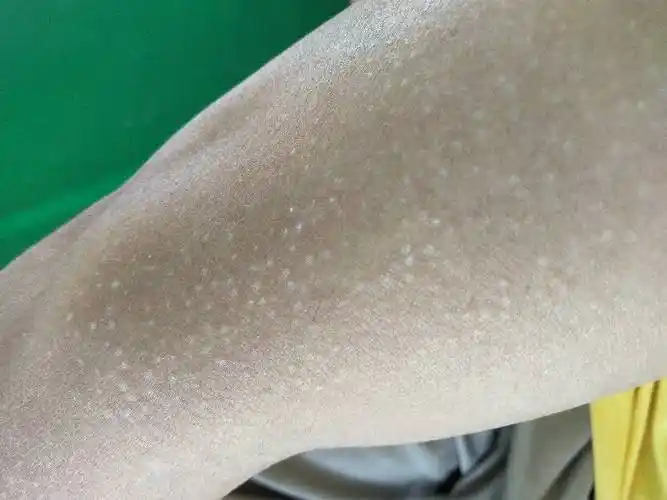 手臂上有白色粒粒不知道是什么,怎么样才能消除?