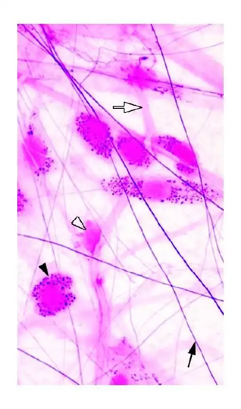 疏松结缔组织纤维的染色特点