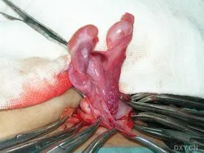 睾丸横过移位图册_百度百科