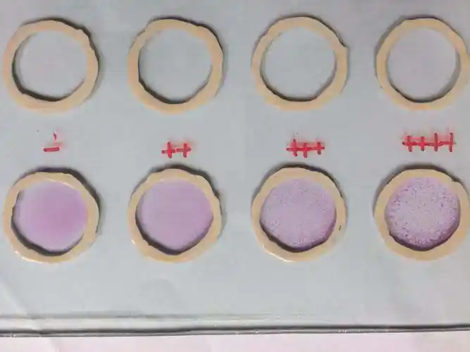 虎红平板凝集法