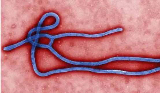 埃博拉(ebola)病毒的呈现