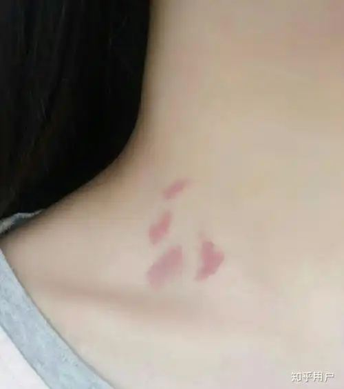 草莓(吻痕)种不出来是为什么? - 知乎