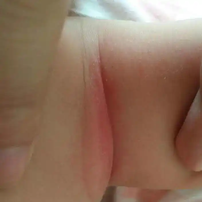 换季须知丨宝宝的皮肤护理不止保湿这一点