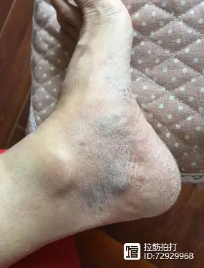 用手掌拍打左脚踝内侧,是怎样一种体验?