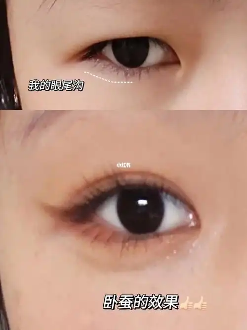 肿眼泡眼尾沟神级卧蚕7575详细教程