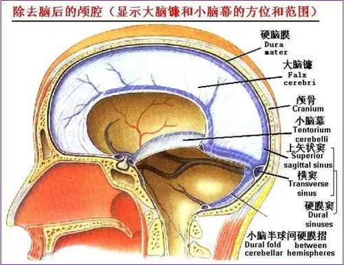 张玉琪:危险的小脑扁桃体疝 - 张玉琪的日志 - 网易博客