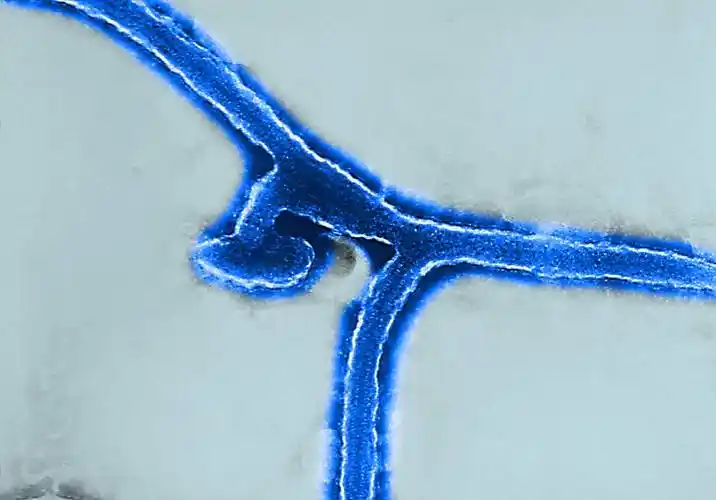 马尔堡病毒——埃博拉病毒的近亲,死亡率达8成,尸体掩埋后还能传染