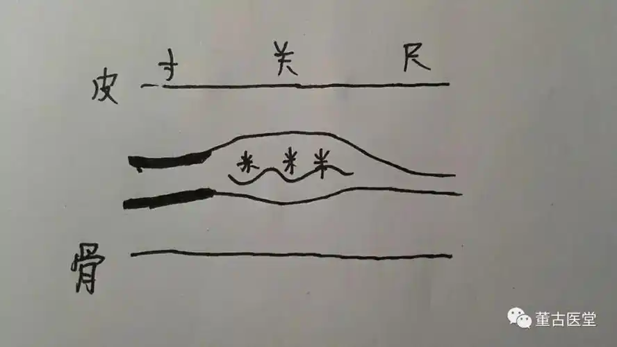 看图学脉诊,临床篇,青春痘