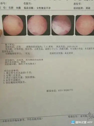 [试管婴儿]5.9号周六上午做完宫腔镜,一