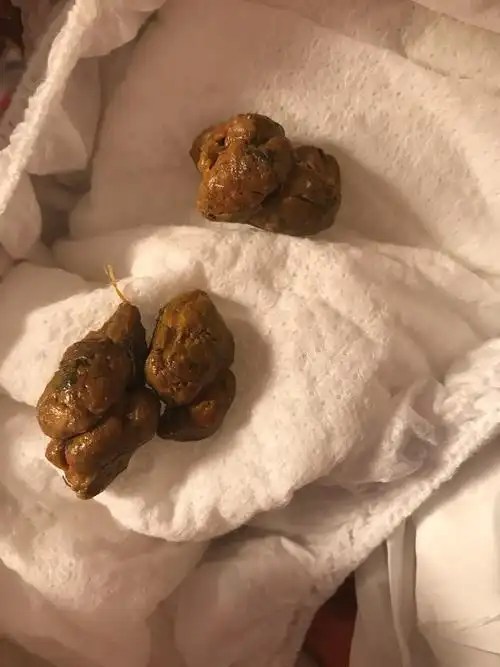 宝妈们,不好意思,发几张便便图片,每天拉的臭臭