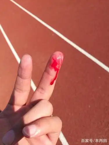 手指受伤作诗一首