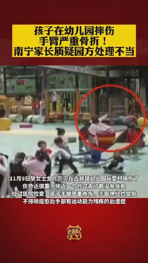 南宁女童在幼儿园摔伤手臂严重骨折
