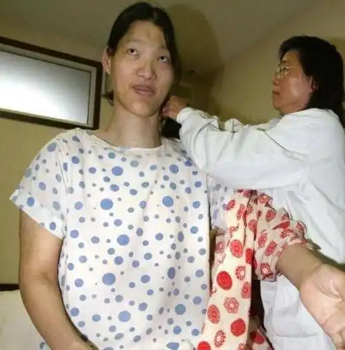 安徽女巨人比姚明高10公分最大的梦想是吃饱饭只活到了41岁